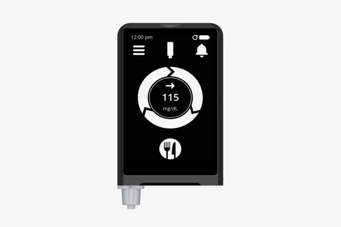 Beta Bionics iLet Insulin Pump: What Makes It Different from Other AID Systems